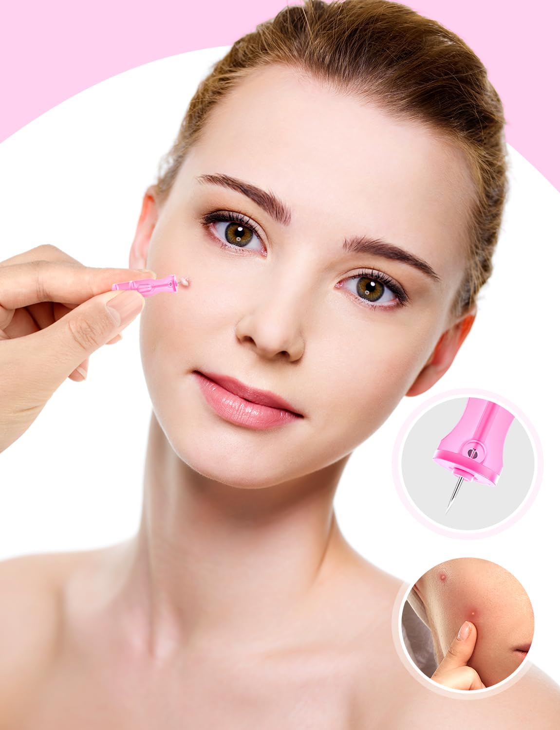 HFWTWPY lancets-blemish-types display demonstrates effectiveness across blackheads and surface acne