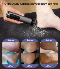 HILUDEER 12000rpm motor foot callus remover for quick dead skin reduction