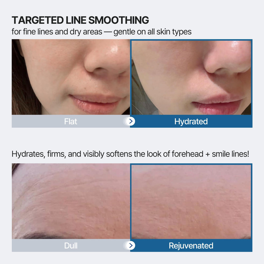 Honeydew Labs patch designed for sensitive skin in a gentle overnight routine.