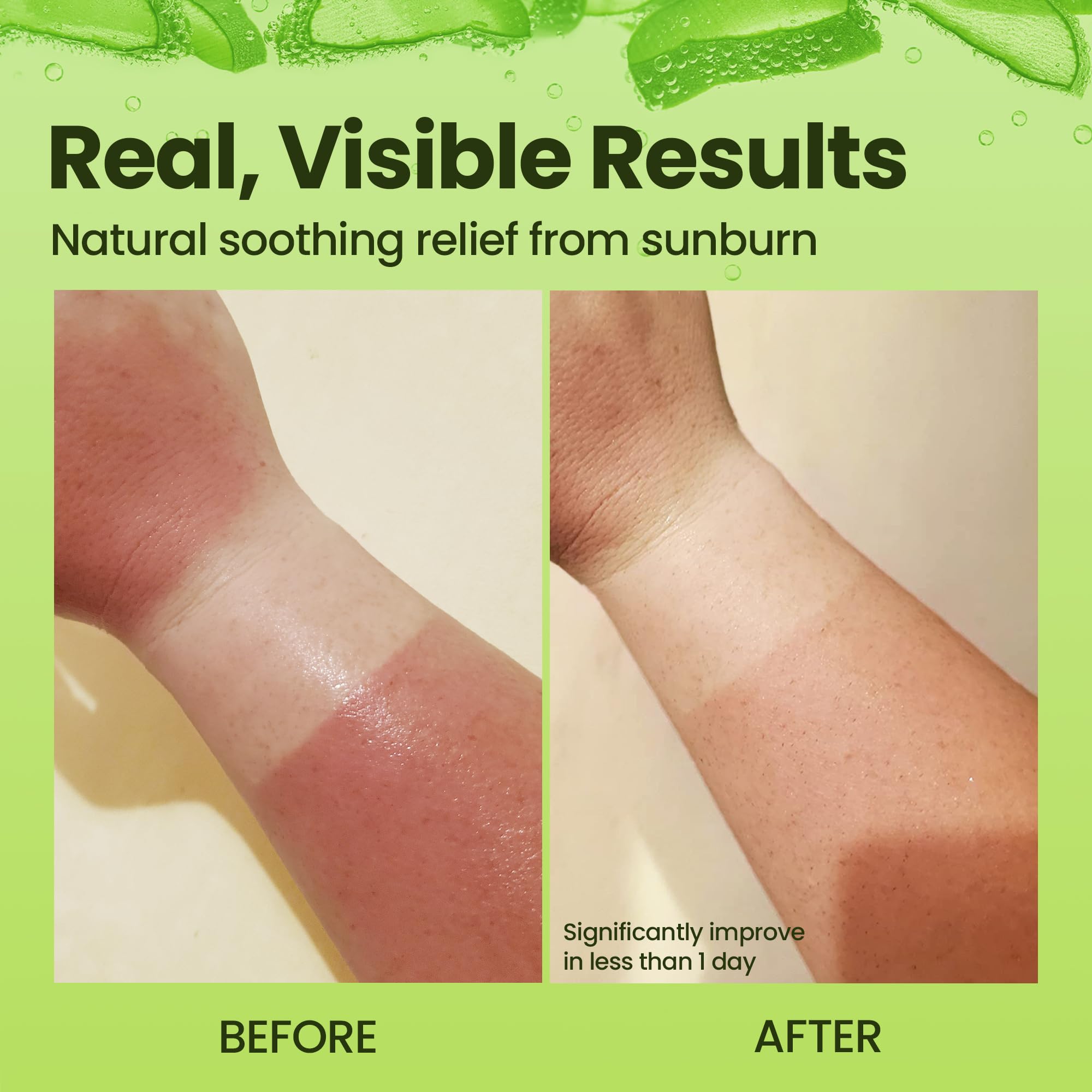 Honeyskin vegan cruelty-free icon with aloe gel packaging implies clean, ethical formula