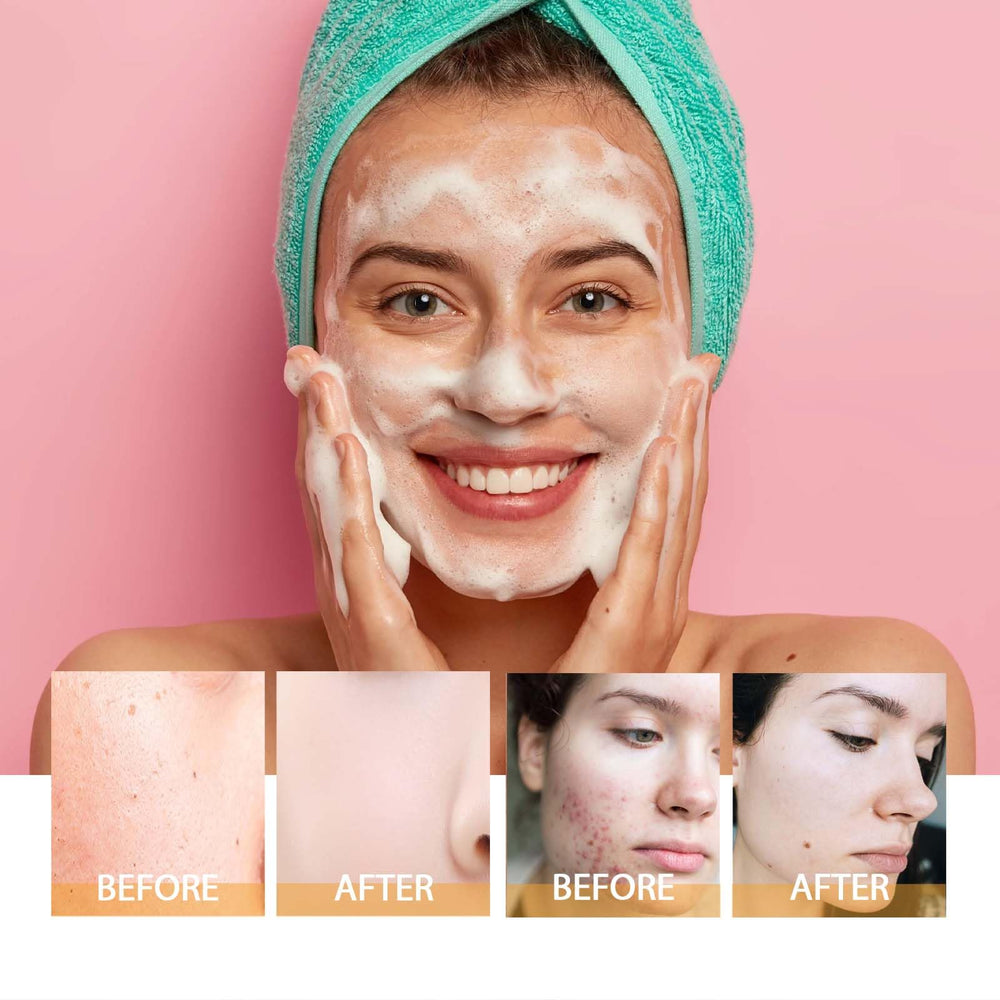 HOYGI Turmeric Face Wash suitable for all skin types