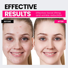 Hunvva EP-300 works with gel to boost product absorption.