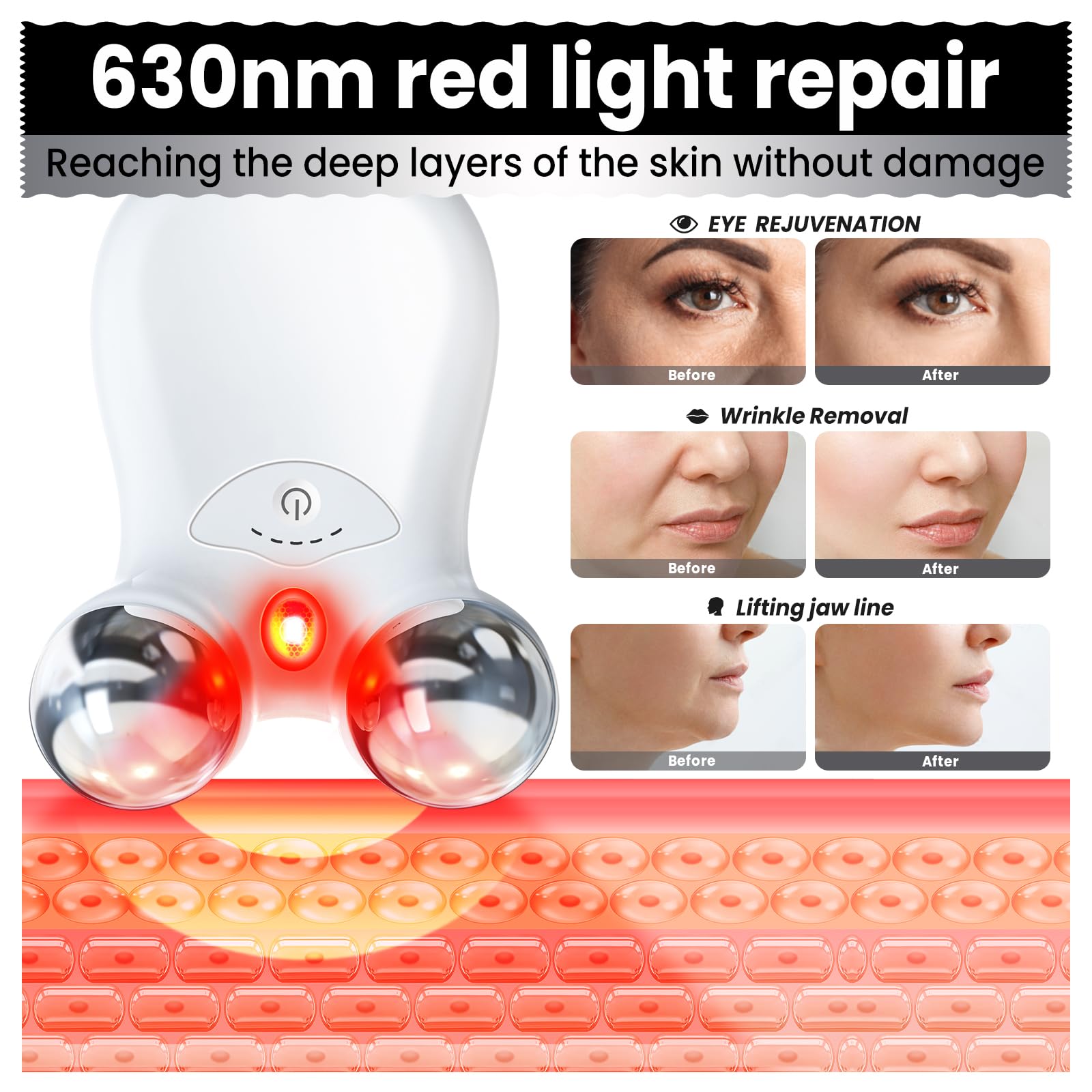 Hunvva EP-300 gel application prepares skin for better absorption