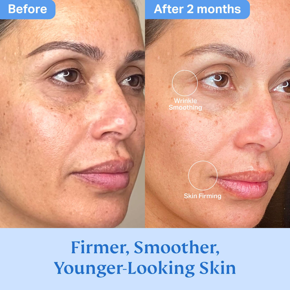 HYDRONOVA dark spot improvement close-up hints at even complexion over time