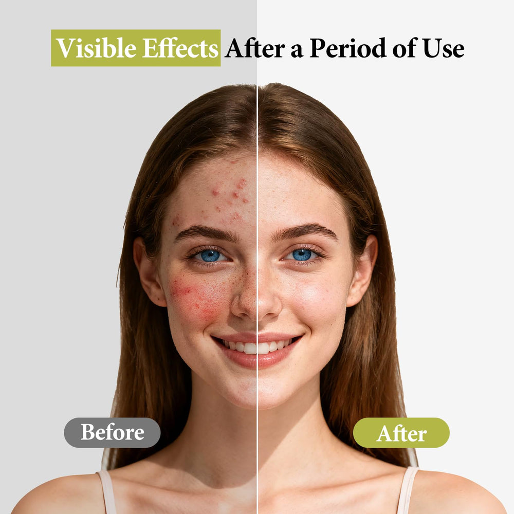 Hyuxeo formula with witch hazel and calendula promotes comfort during use.