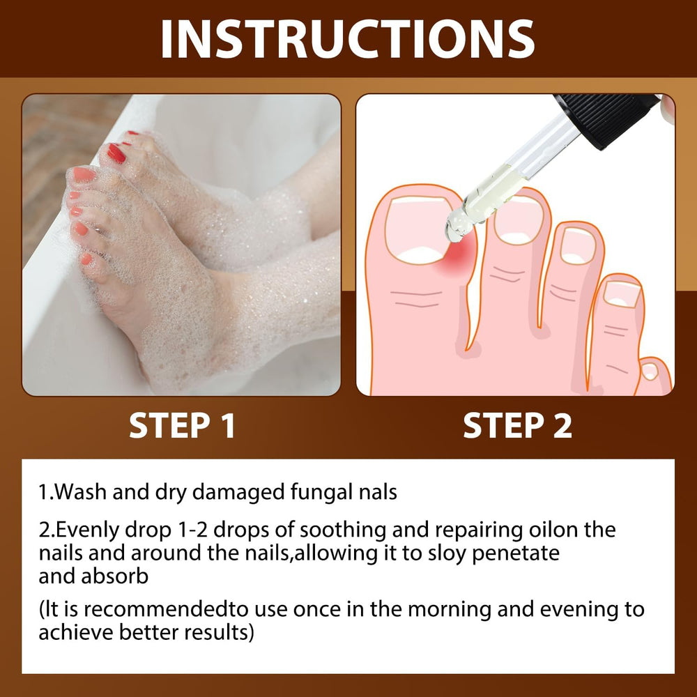 Iaolose paronychia embedded tissue reduction demonstrated during treatment.
