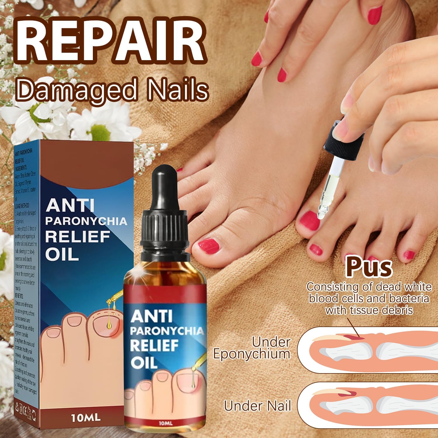 Iaolose paronychia nail care application shown for safe use.