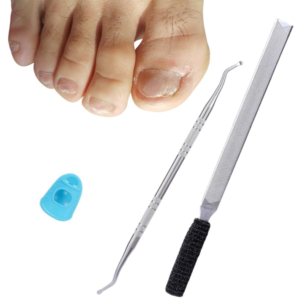 IDOU heavy-duty toenail file with anti-slip grip for thick nails.