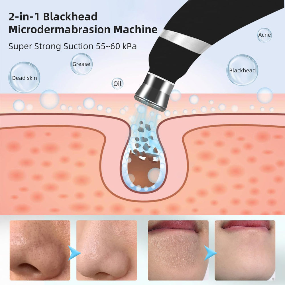 IeBilif Diamond Microdermabrasion device with adjustable suction levels for customized cleansing.