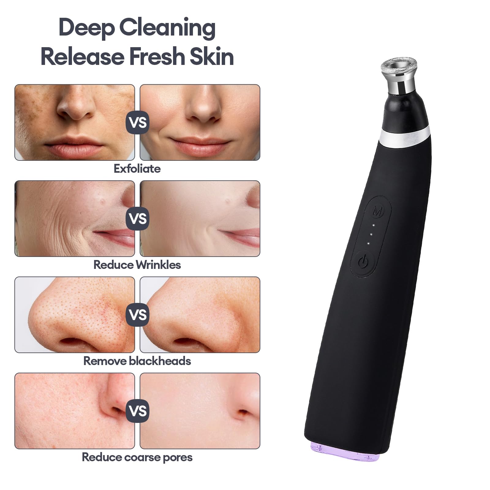 IeBilif Diamond Microdermabrasion in-use scene demonstrating smoother-looking skin.