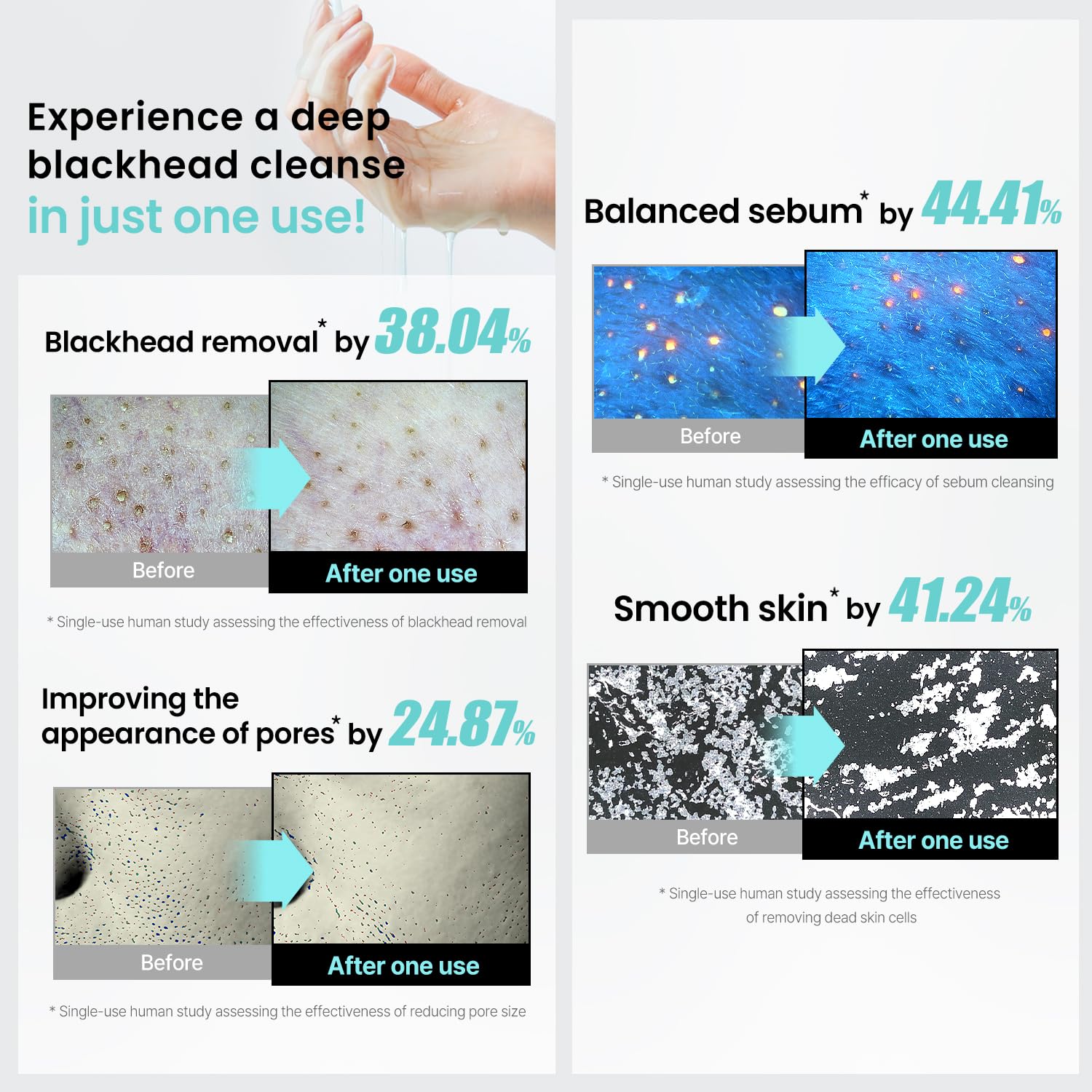 ilso blue pore complex targets clogged pores for balance