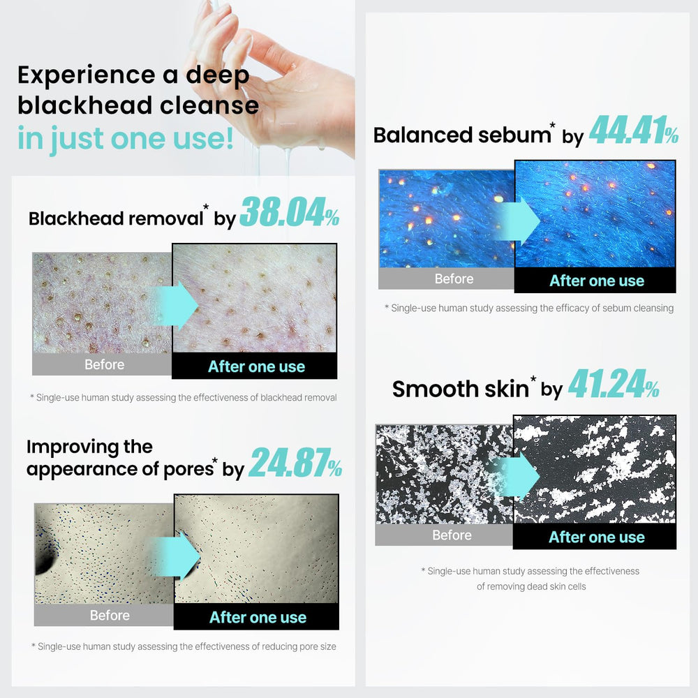 ilso blue pore complex targets clogged pores for balance