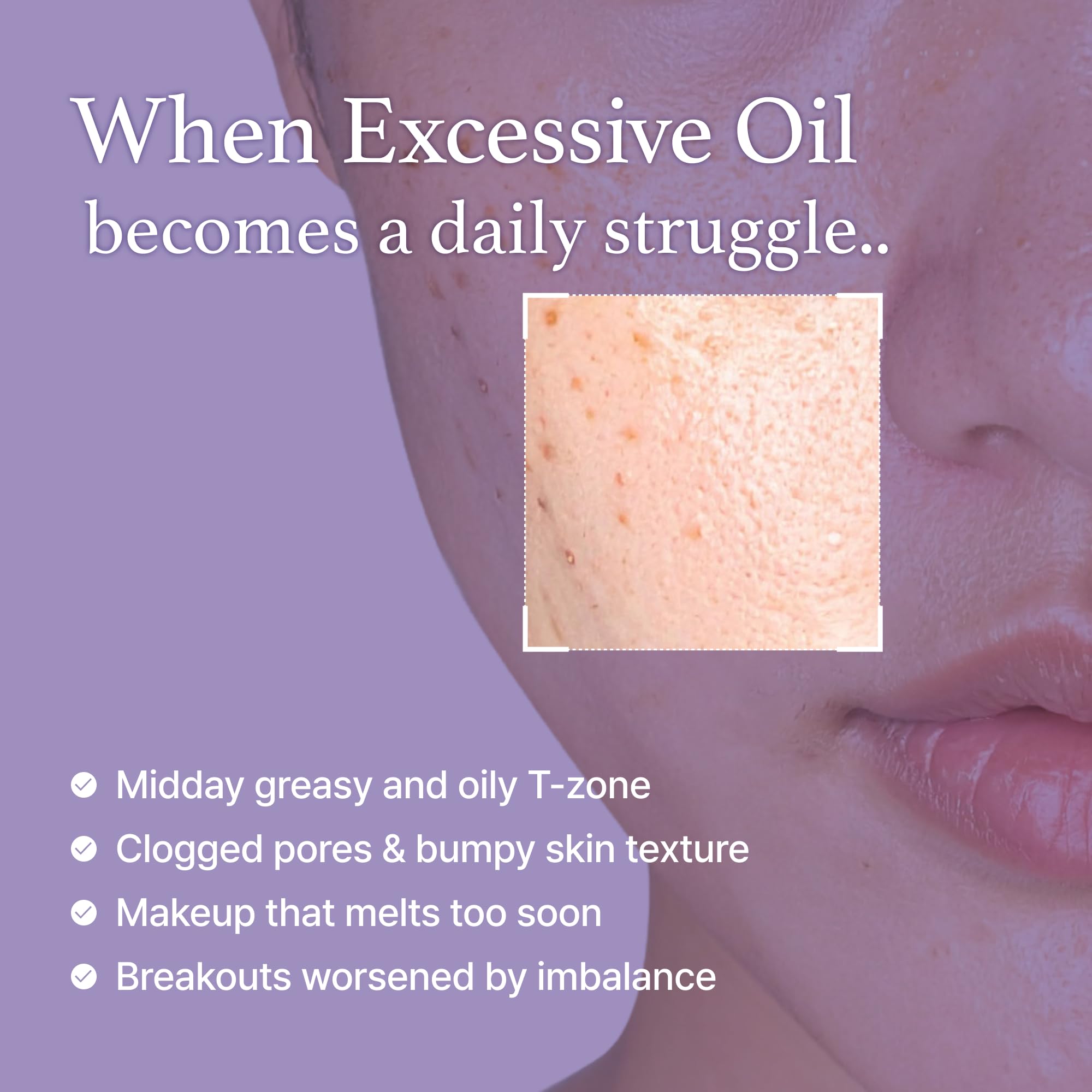 I'm from Black Rice Toner fermented black rice ingredient provides antioxidant-inspired care.