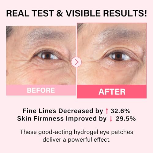 iMethod PDRN Collagen Eye Mask application closeup showing patch precision.