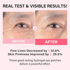 iMethod PDRN Collagen Eye Mask application closeup showing patch precision.