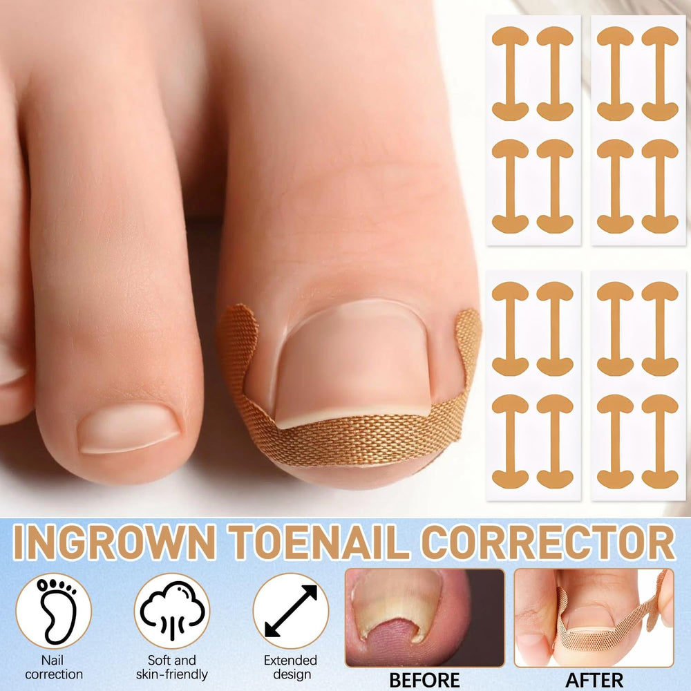IMOLL nail tools in use demonstrate beginner-friendly kit for easy edge correction.
