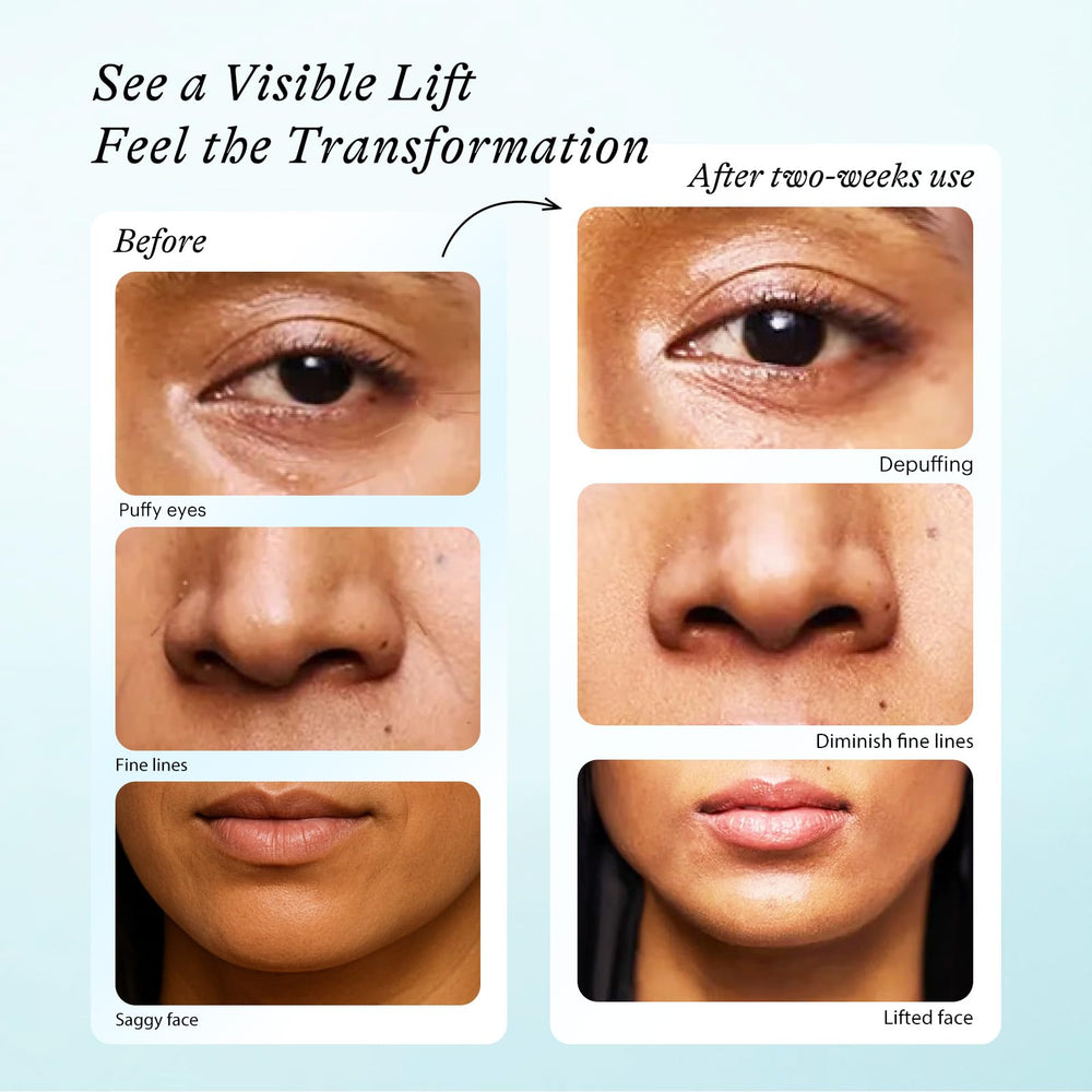 In My Eyes dual-roller system delivers precise eye-area acupressure and smooth orbital glides