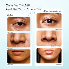 In My Eyes dual-roller system delivers precise eye-area acupressure and smooth orbital glides