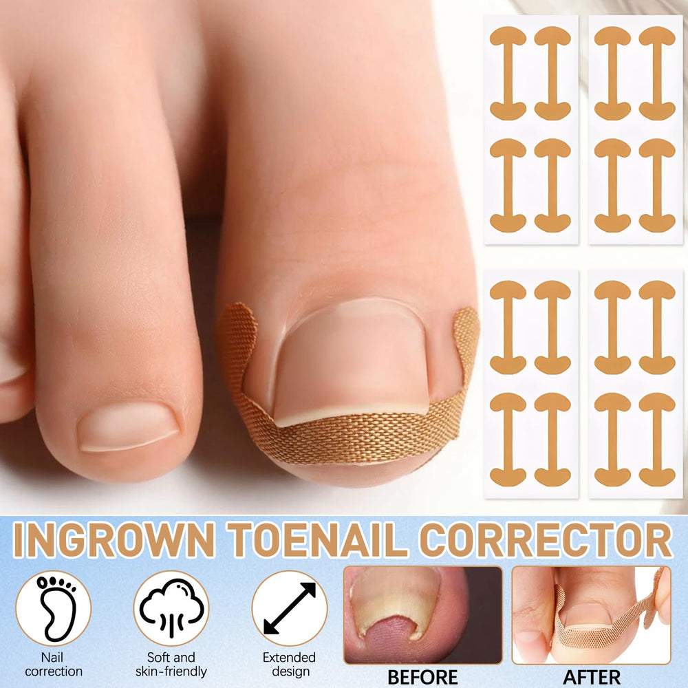 Ingrown Toenail Corrector Set breathable material ensures soft, non-irritating wear.