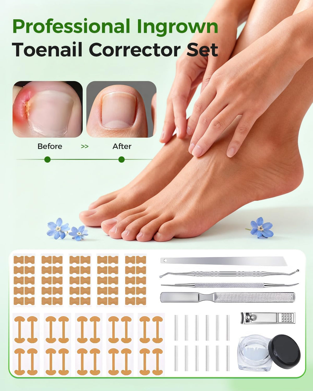 Ingrown Toenail Corrector Set curved patches designed to support nail growth direction.