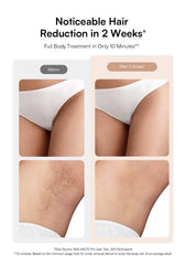 INIA HAUTE Pro ice cooling surface protects skin during treatment