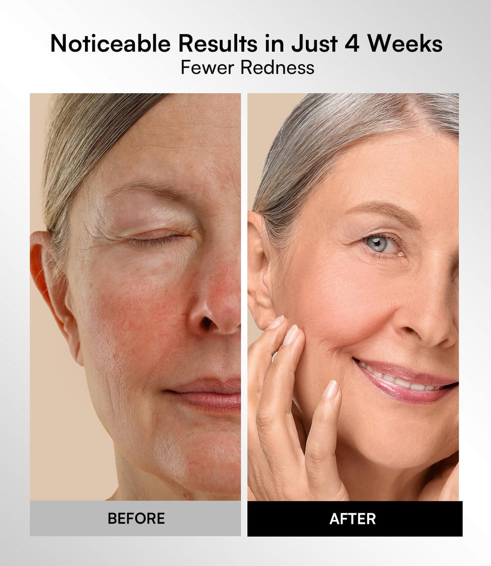 INIA mask ergonomic-fit shows comfortable, secure wear during treatment