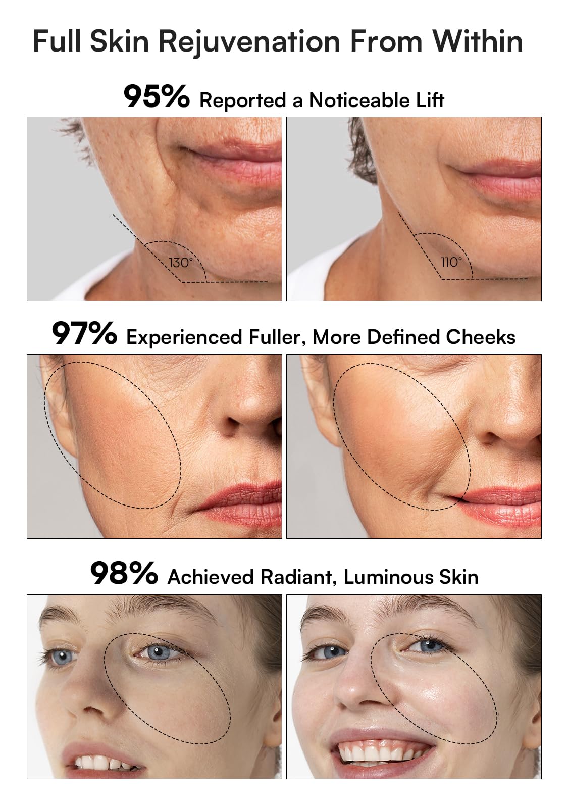 INIA True Beauty Glow facial massager in close-up for soothing sessions