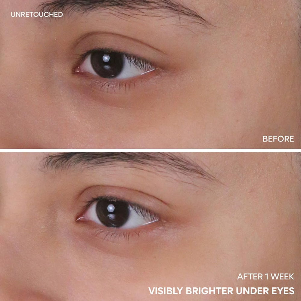 innisfree Vitamin C Niacinamide Eye Serum suitable for all skin types
