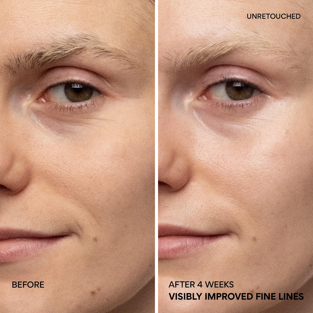 Innisfree lip area close-up shows targeted conditioning with serum.