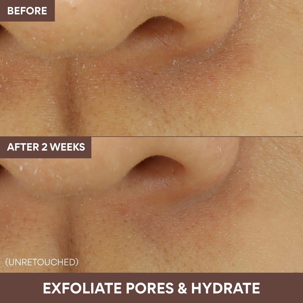 Innisfree Volcanic Swirl creates a subtle glow on skin post-use