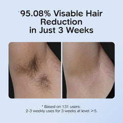 INNZA IPL 600nm, 5J/cm2 energy targets follicles more deeply