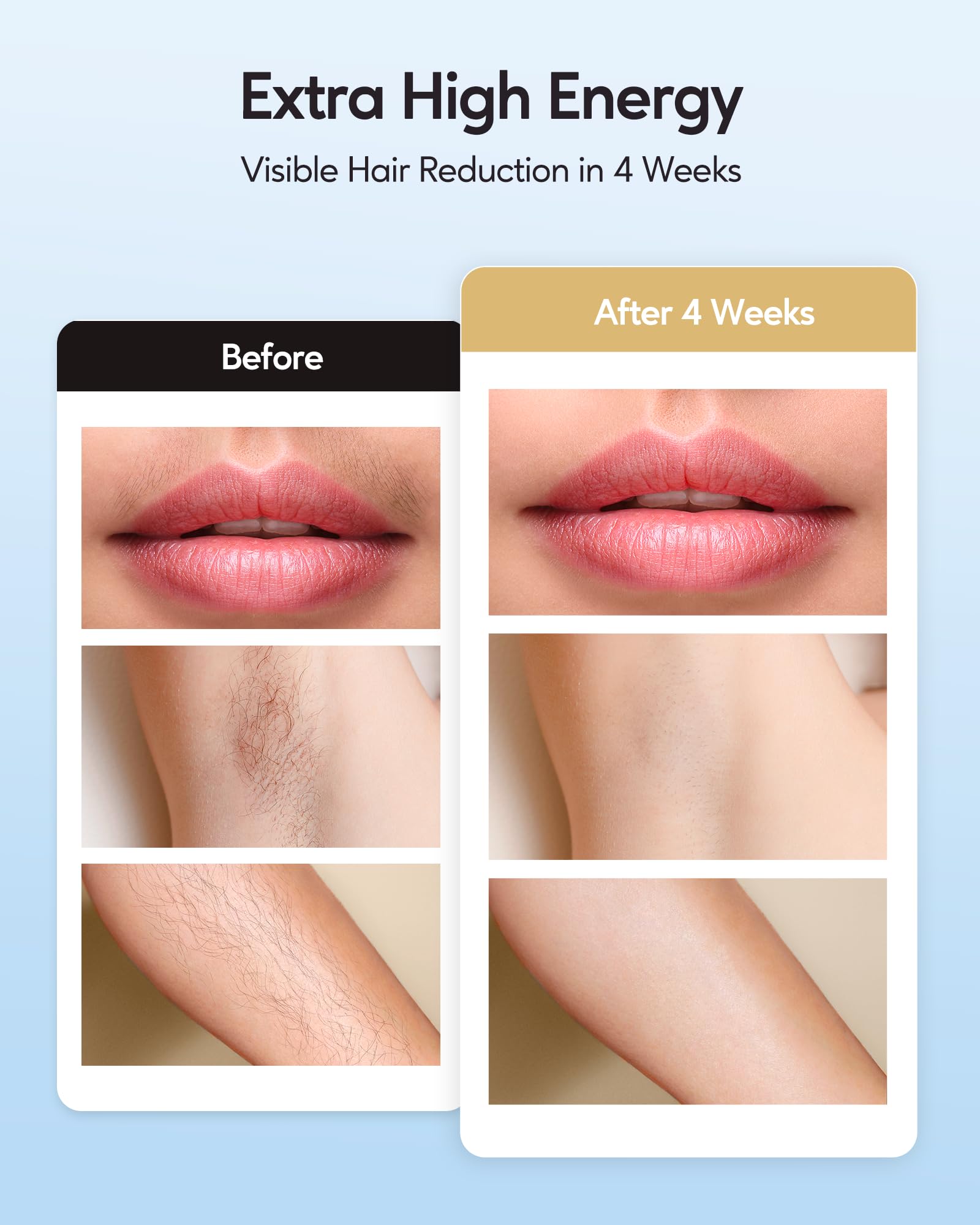 INNZA IPL device auto mode for large-area treatments.
