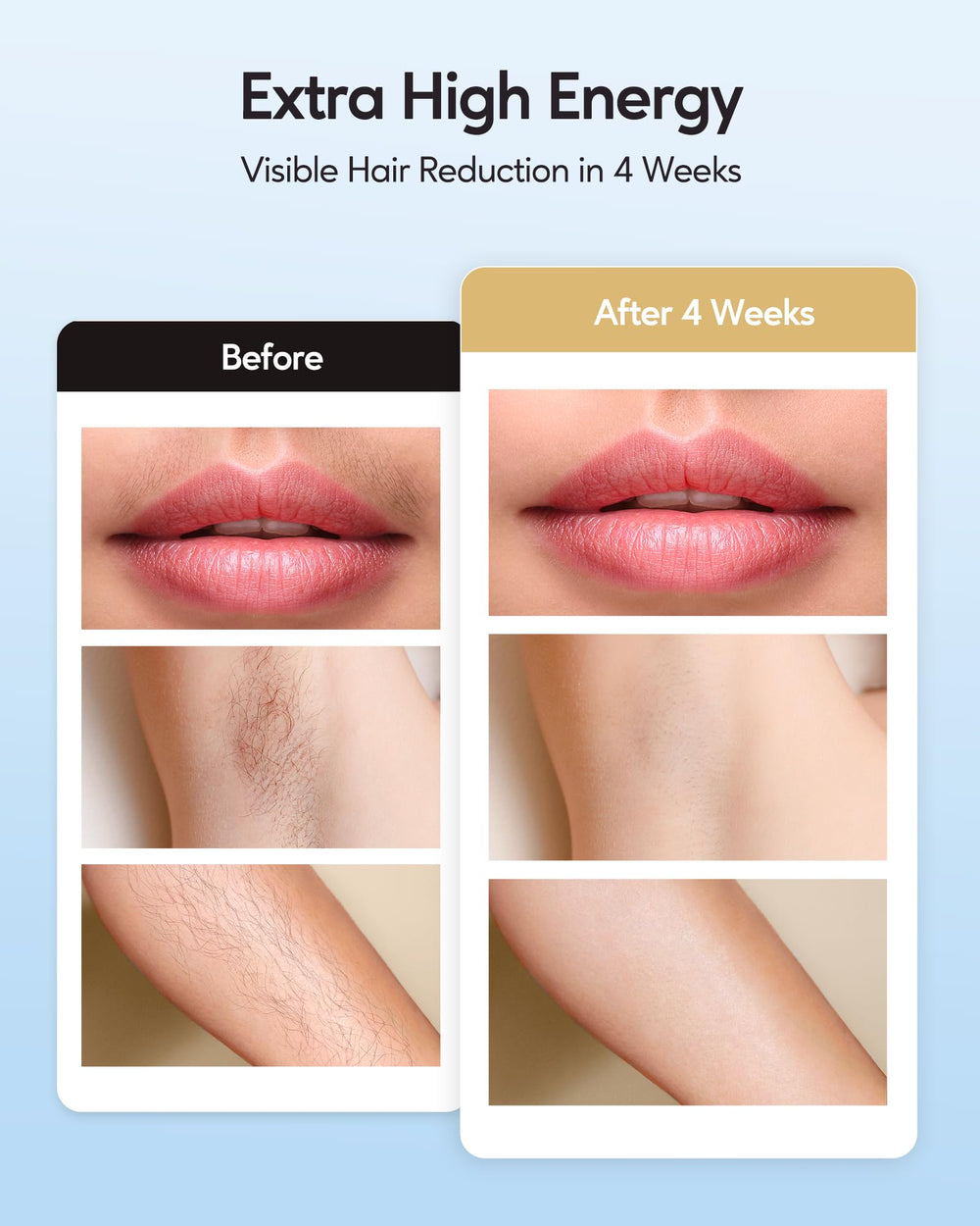 INNZA IPL device auto mode for large-area treatments.