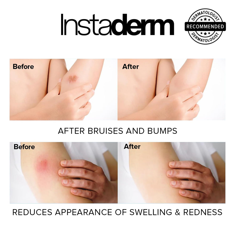 Instaderm Vitamin K Cream dispensing pump for easy daily application.
