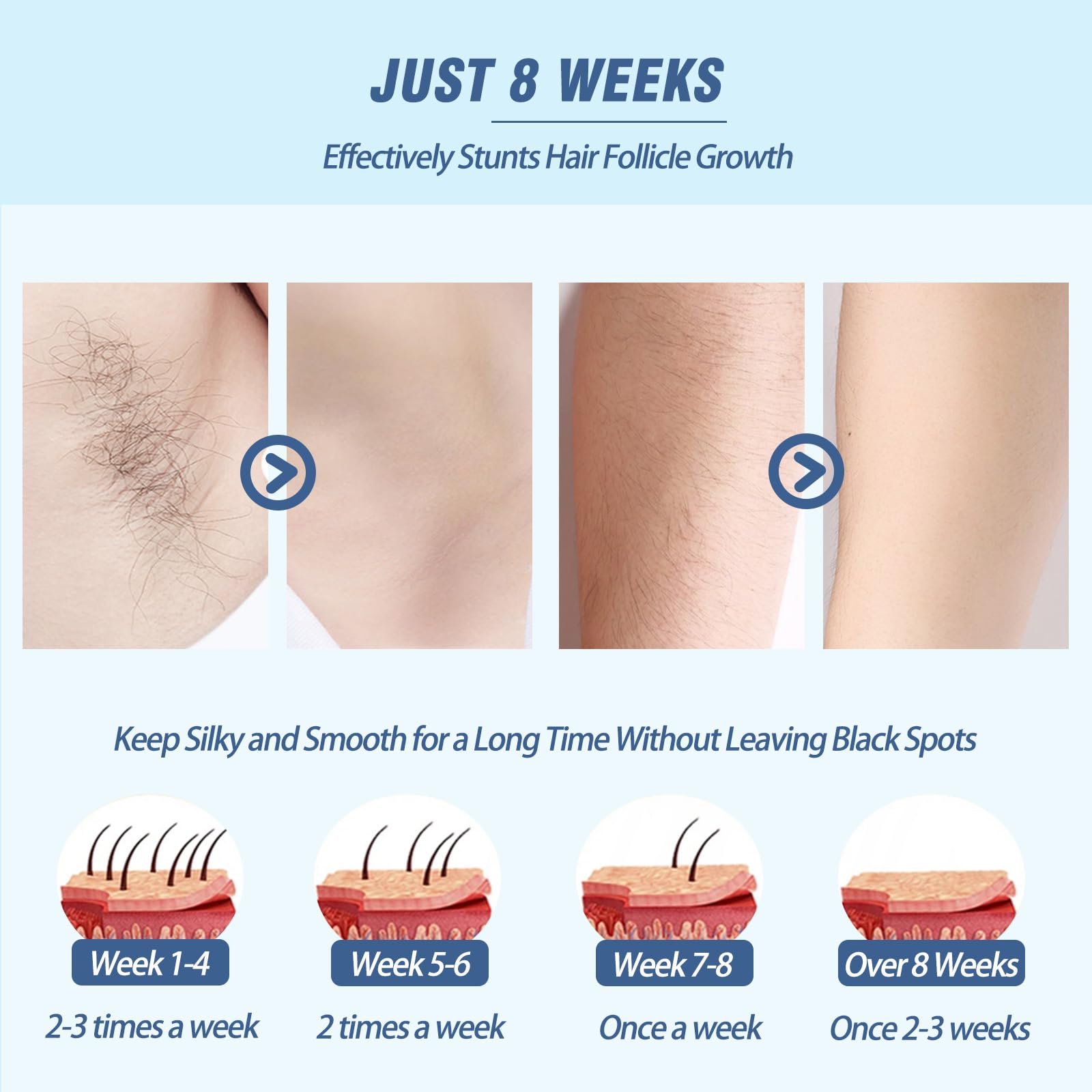 Iouniya laser hair removal device close-up on control buttons for adjustable levels and comfort