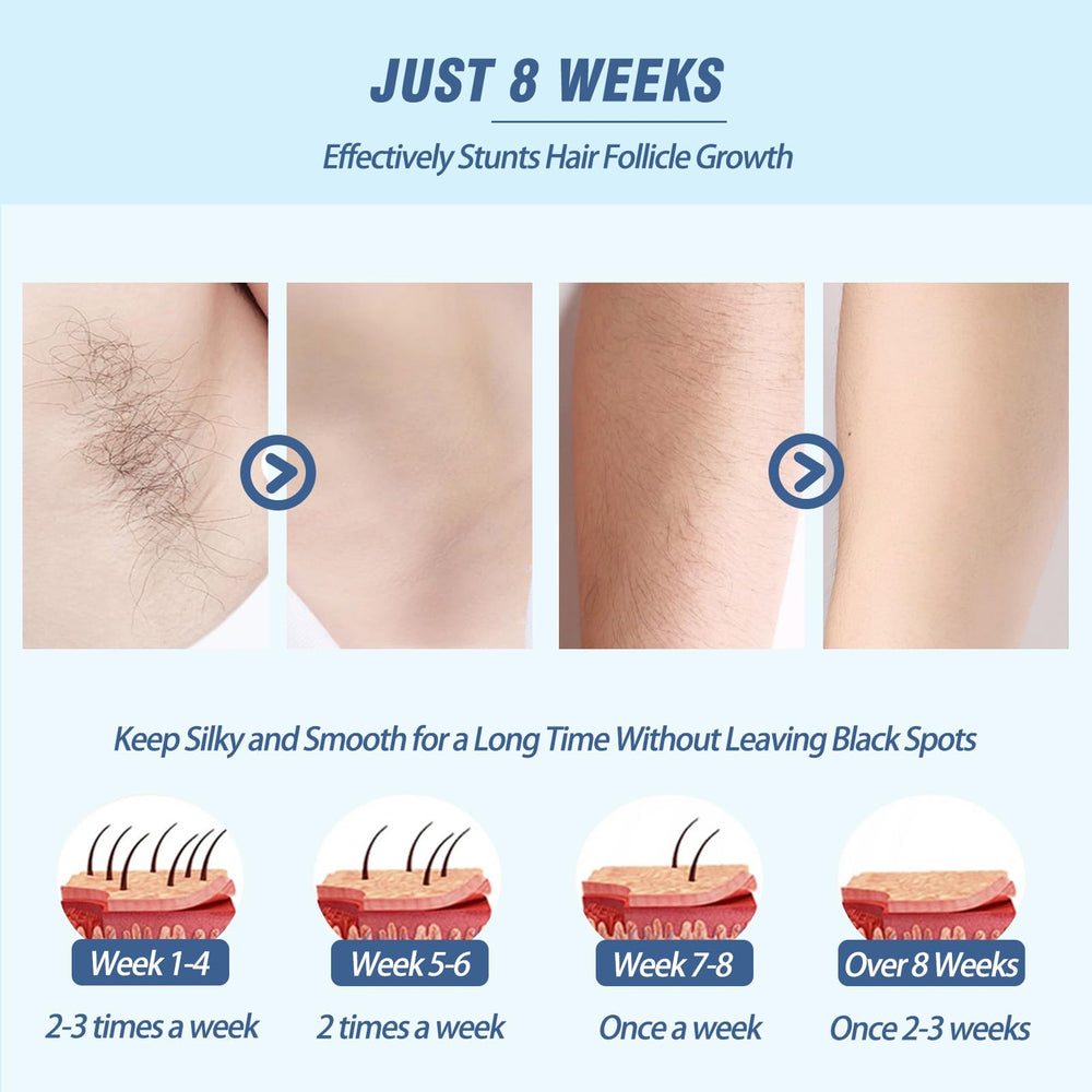 Iouniya laser hair removal device close-up on control buttons for adjustable levels and comfort