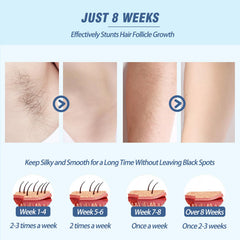 Iouniya laser hair removal device close-up on control buttons for adjustable levels and comfort