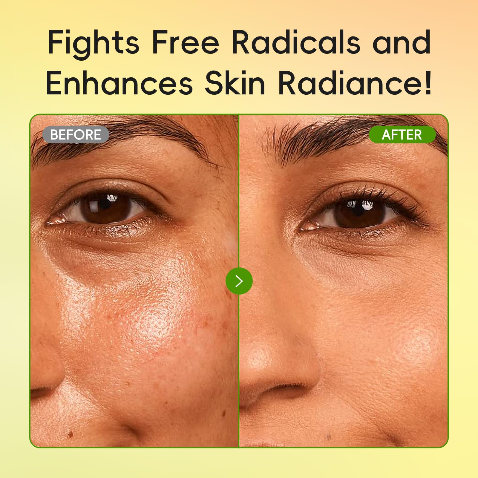 QUIYUM Skincare Set gift-pack display shows a complete routine for oily skin