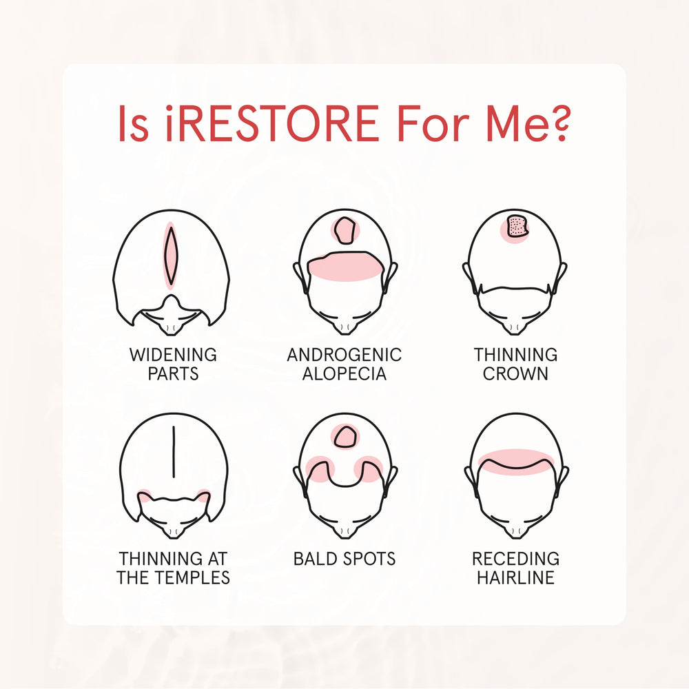 irestore dry hair moisture repair emphasis on scalp nourishment