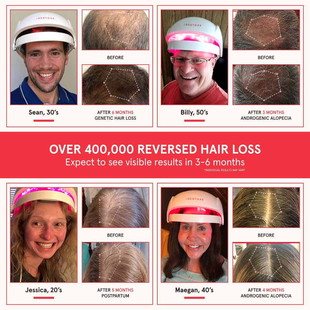 iRestore Essential cap on head for hands-free, convenient hair regrowth sessions.