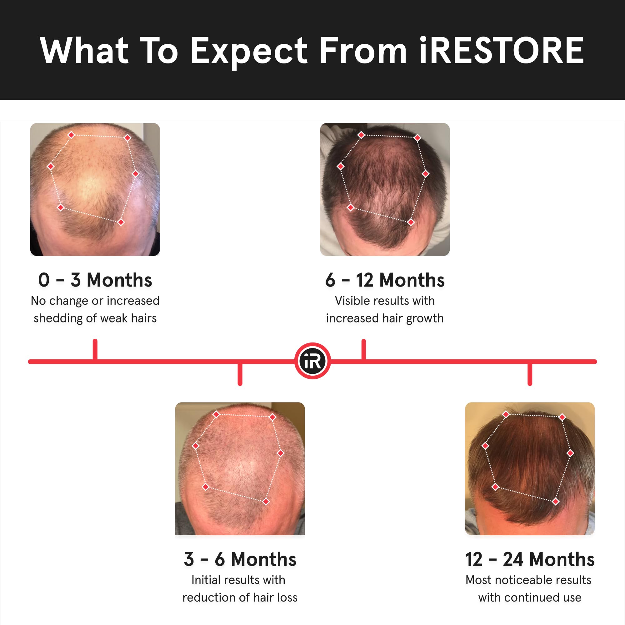 iRestore Essential compact design for portable, easy home use.