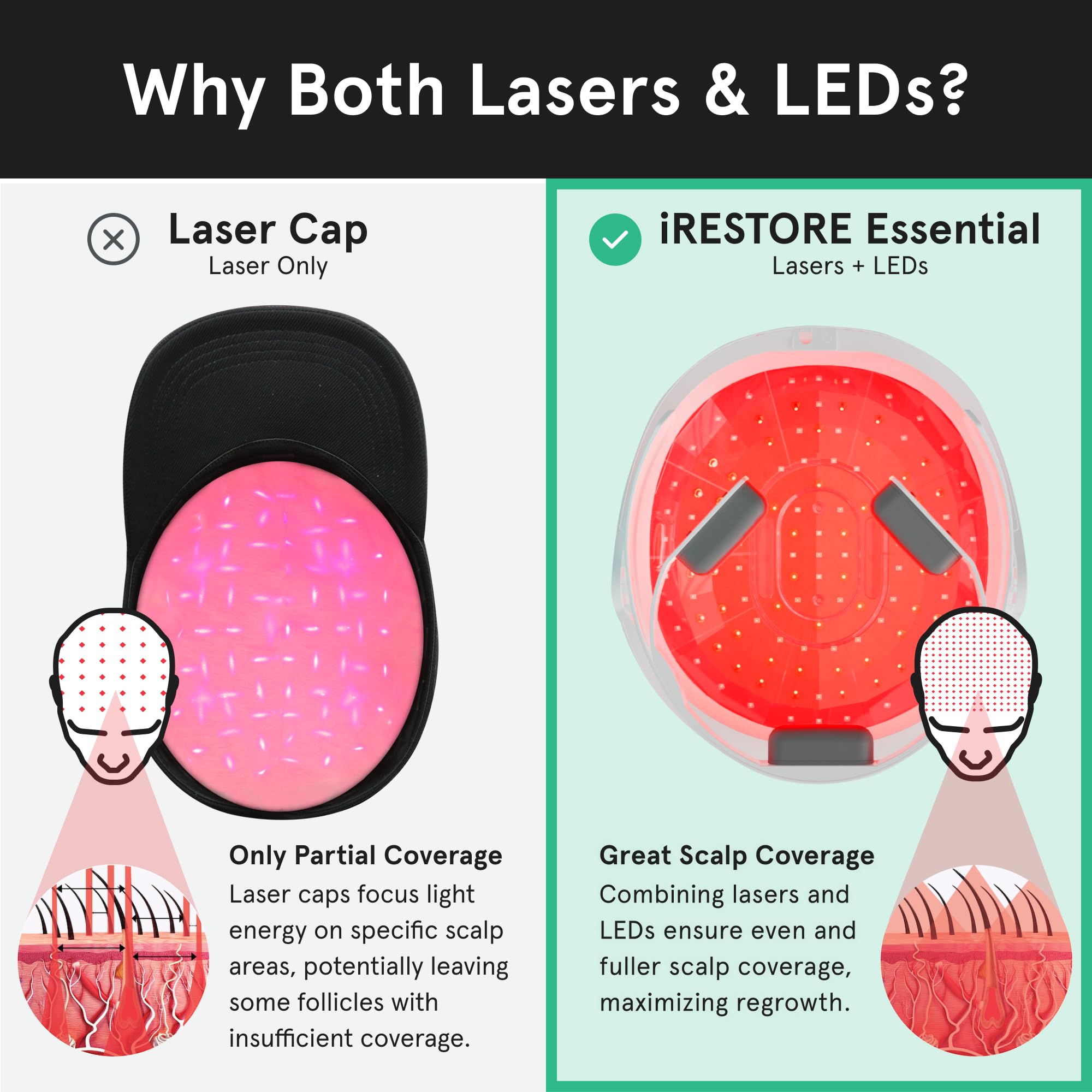 iRestore Essential Laser Hair Growth System cordless session for flexible routine.