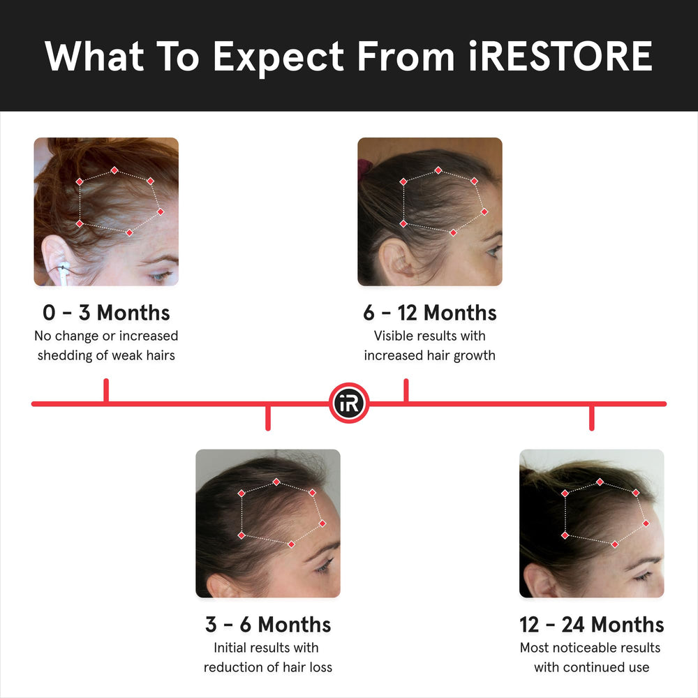 iRestore Essential Laser Hair Growth System daily-use device for thinning hair