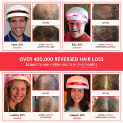 iRestore Essential Laser Hair Growth System rechargeable battery for cordless sessions.