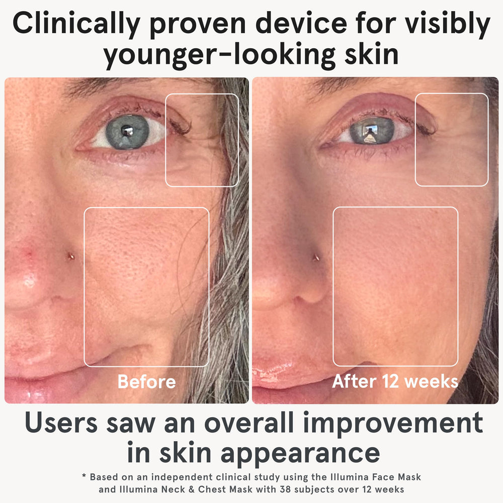 iRestore LED mask showcasing red blue infrared wavelengths for targeted skin goals.