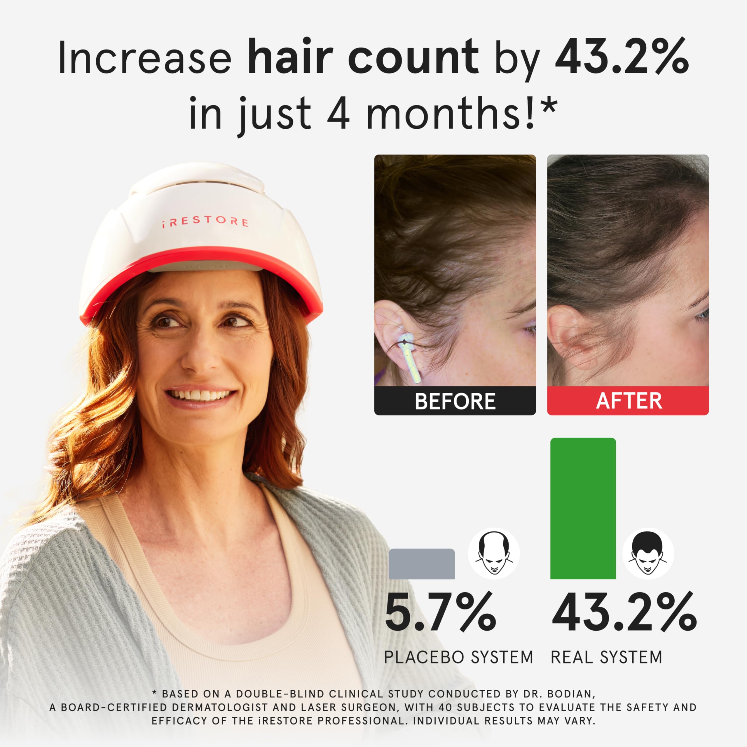 iRestore Pro demonstrates secure head fit for stable scalp coverage.