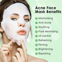 Applying IREV Anti Acne Mask on the face for soothing, controlled use.