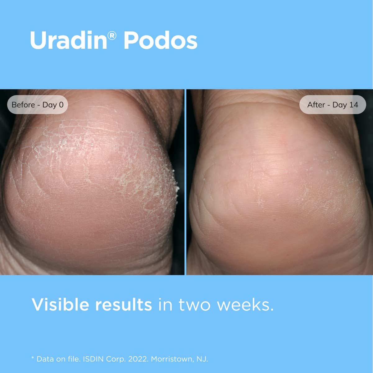 ISDIN Dermatologically Tested label closeup indicating safety for feet
