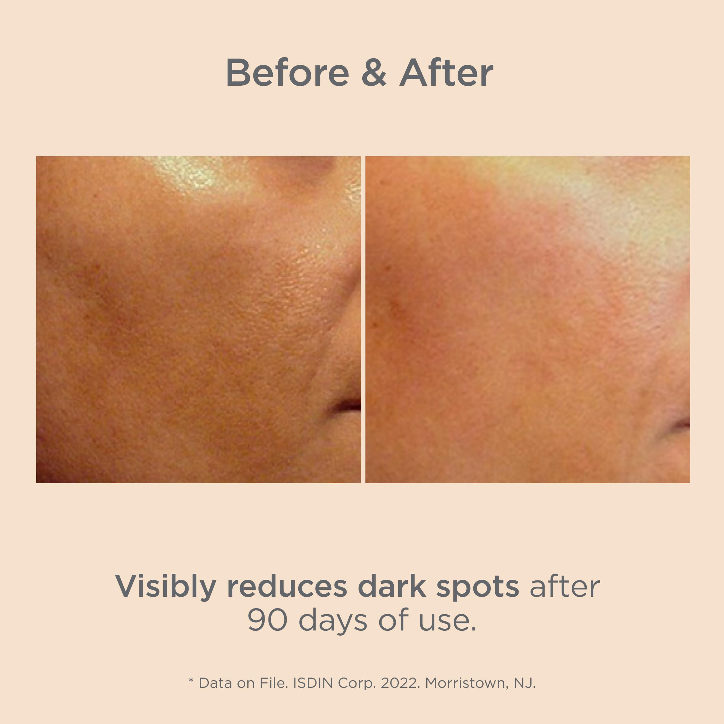 Isdin Melaclear sun-exposure spots focus image highlighting targeted correction