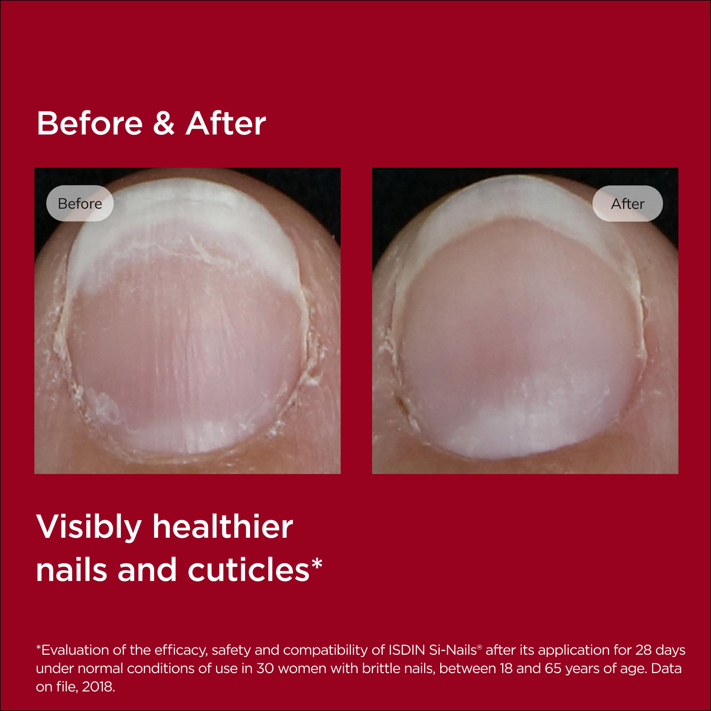 ISDIN Si-Nails packaging highlights keratin support from pistacia lentiscus gum.